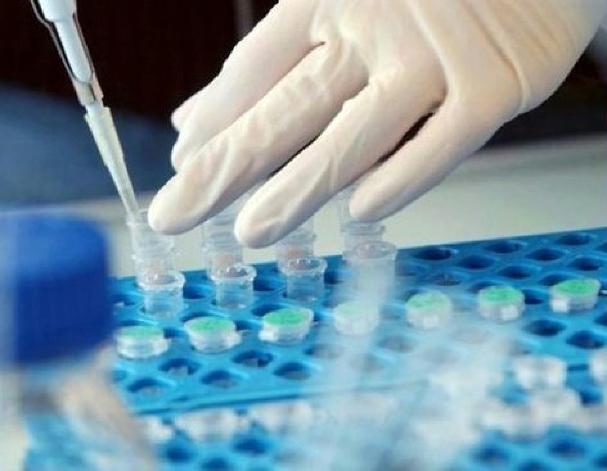 Biotech-sector: kleine bedrijven zoeken aansluiting bij 'grote jongens'