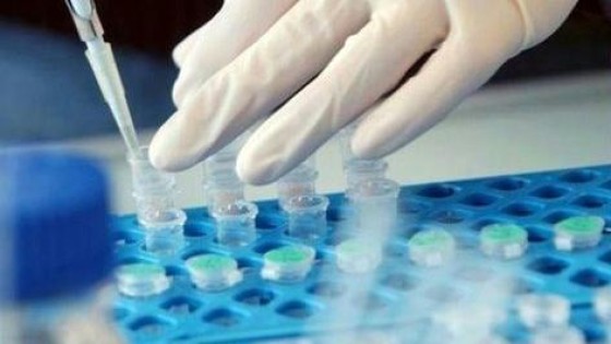 Team investment managers nieuw fonds Life Science Partners compleet