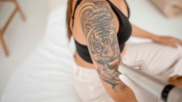 Factory Capital aan boord van tatoeageverwijderaar